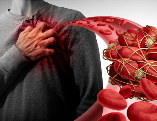 Hati-Hati, Pasien Virus Corona Bisa Alami Pembekuan Darah Misterius