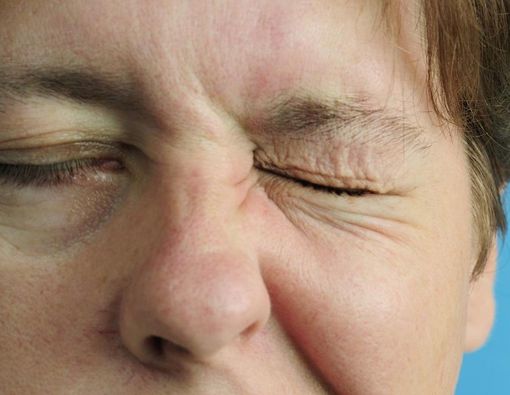 Kelumpuhan Wajah, Perlukah Antivirus?