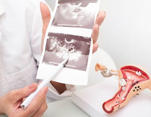 Ovarium pada Wanita, Fungsi, Struktur dan Gangguan yang Bisa Terjadi