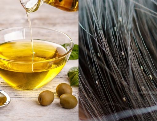 Apakah Efektif Membasmi Kutu Rambut dengan Minyak Zaitun?