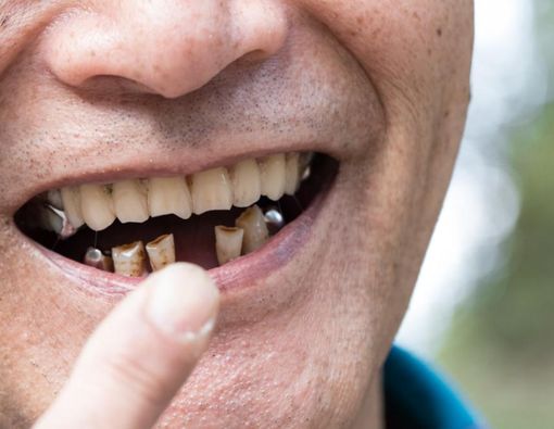 Amankah Penggunaan Obat Penumbuh Gigi?