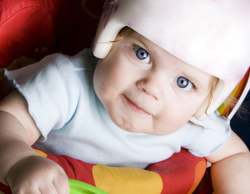 Flat Head Syndrome, Penyebab Kepala Bayi Datar