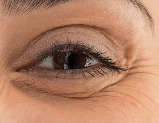 Cara Mudah Hilangkan Kerutan di Ujung Mata