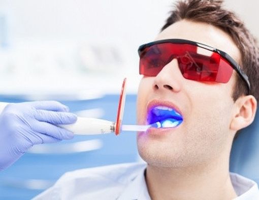 Gigi Sehat Terawat dengan Terapi Laser