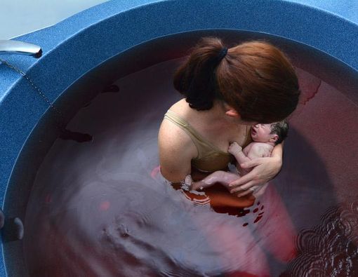 Menilik Keuntungan dan Risiko Water Birth