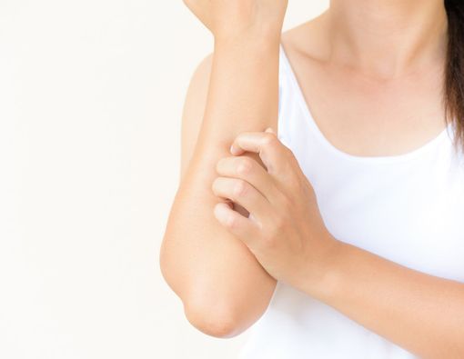 4 Penyakit Kulit Ini Rentan Muncul di Musim Hujan