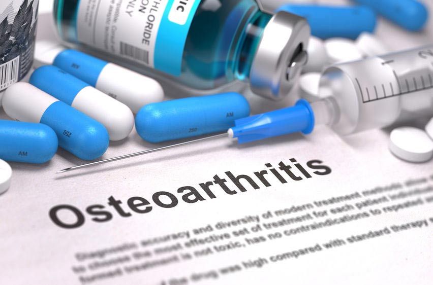 Untuk Osteoartritis, Lebih Baik Obat Oles atau Obat Minum?