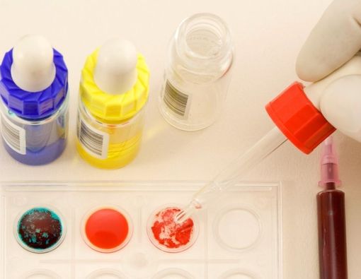 Studi Terbaru: Golongan Darah Tak Pengaruhi Infeksi COVID-19