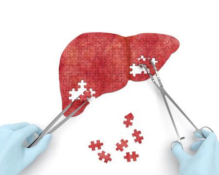 Serba-serbi Transplantasi Hati