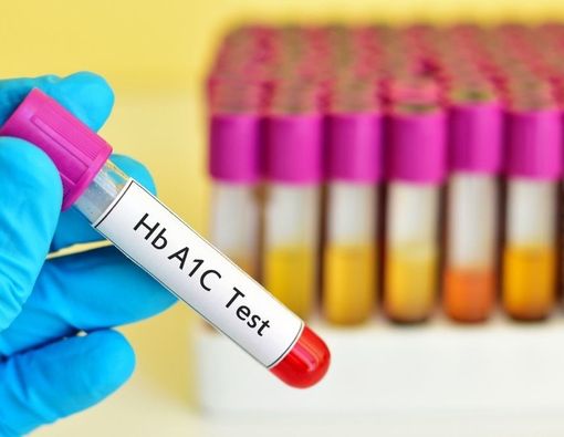 Mengenal Pemeriksaan HBA1C untuk Mengontrol Diabetes