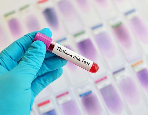 Mengungkap Fakta Medis seputar Penyakit Thalasemia