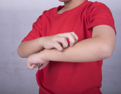 5 Kebiasaan Ini Bisa Memperburuk Alergi yang Dialami Anak