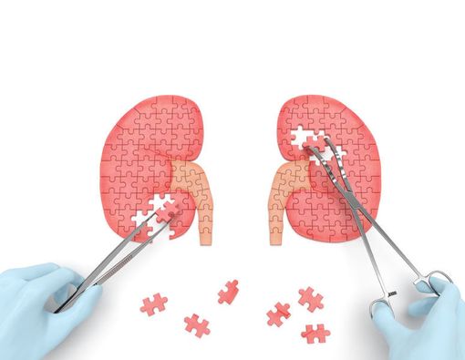 Kapan Batu Ginjal Harus Dioperasi?