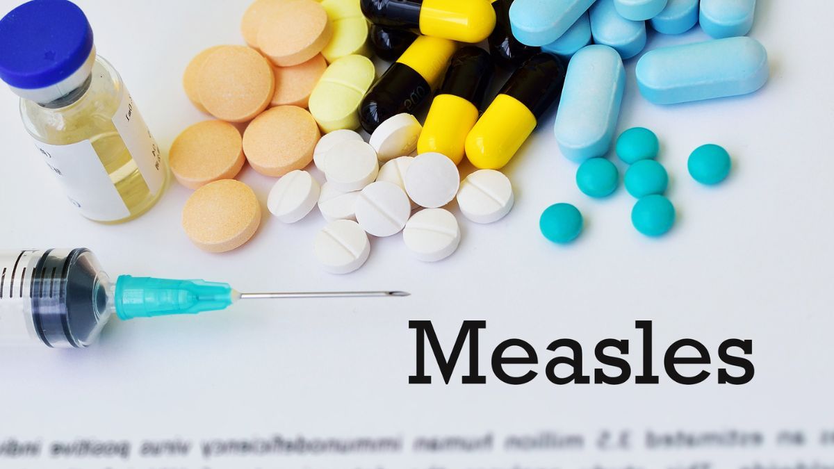 3 Jenis Obat untuk Meredakan Gejala Penyakit Campak