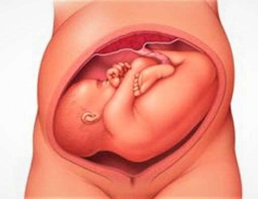 Posisi Bayi Melintang, Bisakah Berubah Jelang Kelahiran?