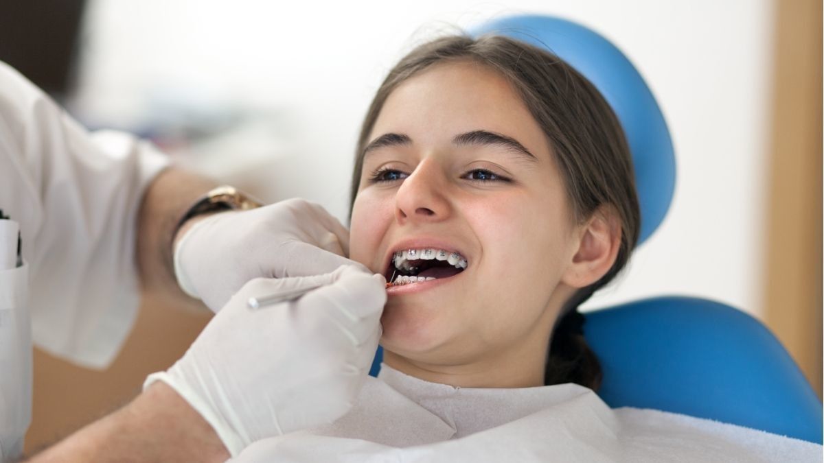 Manfaat dan Risiko Penggunaan Power Chain Braces KlikDokter