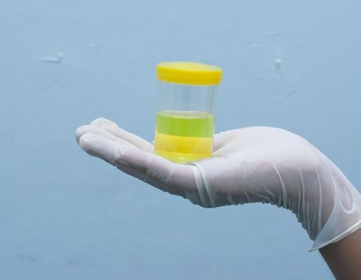 Mengenal Tes Noninvasif untuk Mendeteksi Sel Kanker