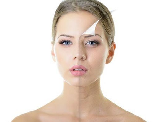 Langkah-Langkah untuk Memulihkan Kulit Kusam