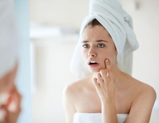 Tip Memilih Sabun untuk Kulit Berjerawat