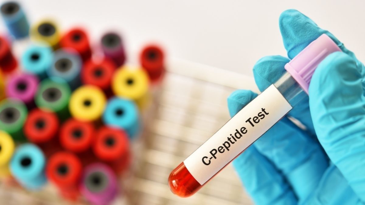 Mengenal Tes C-Peptide untuk Penderita Diabetes