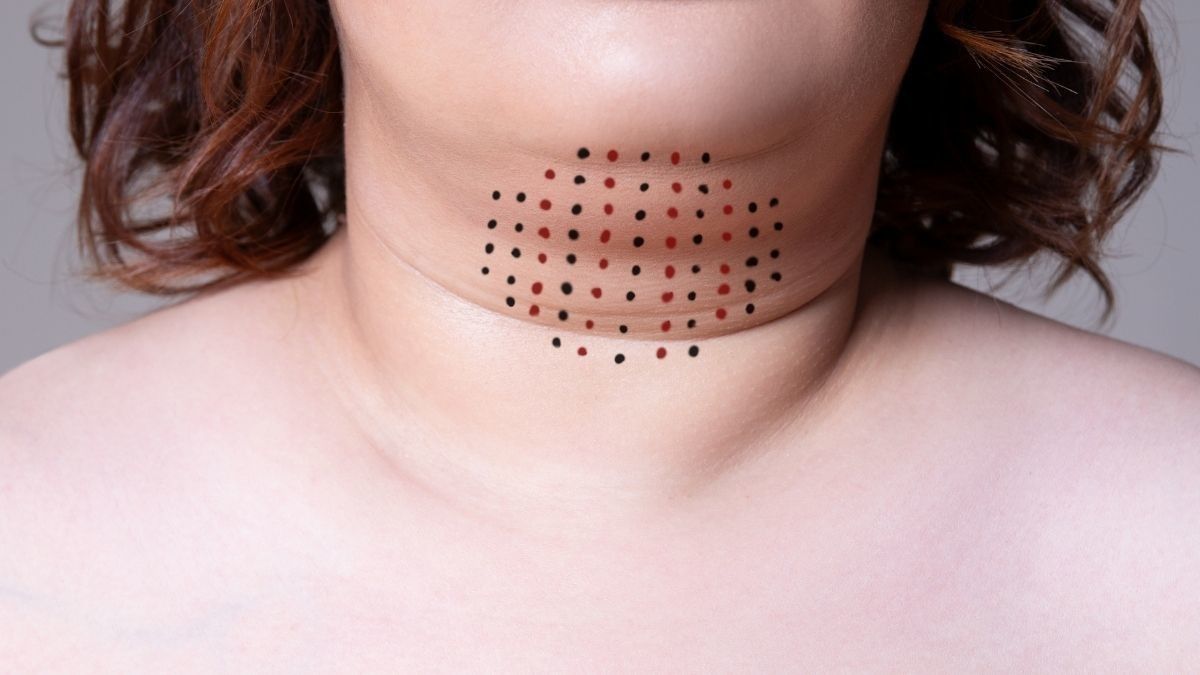Gerakan Senam Wajah untuk Menghilangkan Double Chin