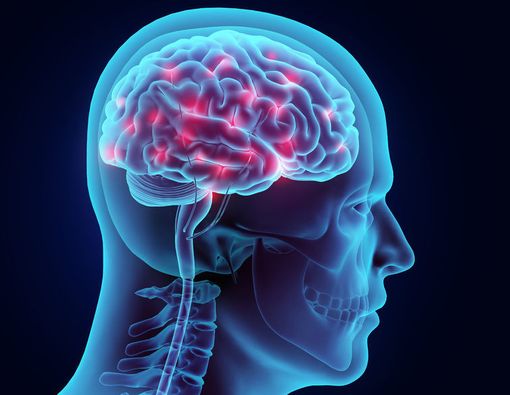 Fakta Medis Lengkap Seputar Stroke Iskemik