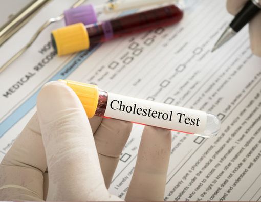 Segudang Dampak Negatif Obesitas dan Kolesterol Tinggi