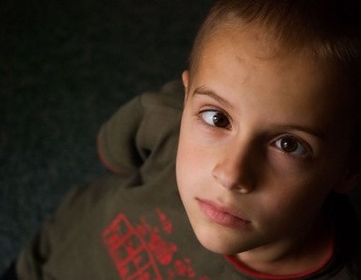 Sindrom Mata Malas atau Amblyopia