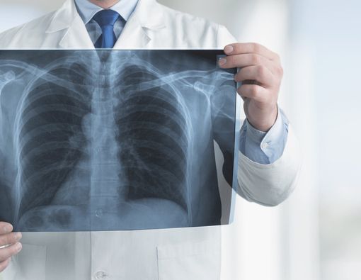 Kenali Penyakit Paru-Paru Popcorn Lebih Dekat