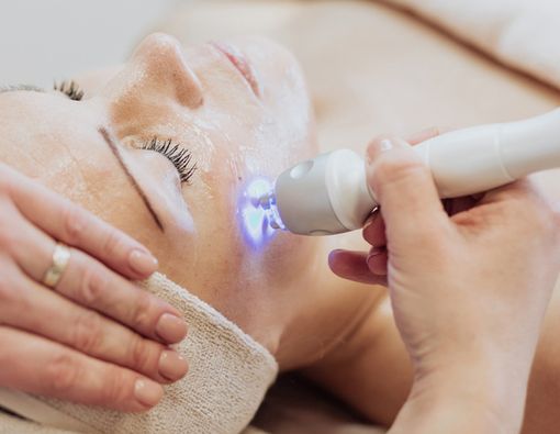 Terapi Laser untuk Flek Hitam di Wajah, Efektifkah?