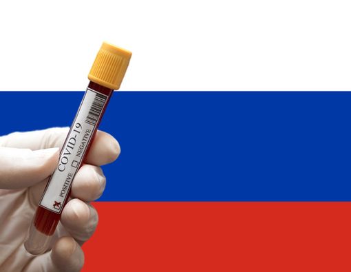 Rusia Klaim Berhasil Temukan Obat COVID-19, Ini Penjelasannya