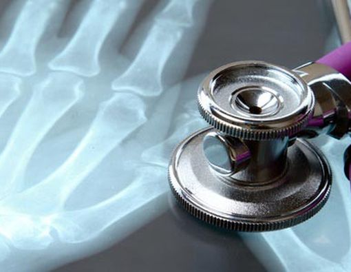 Perbedaan Utama Osteoporosis dan Osteopenia