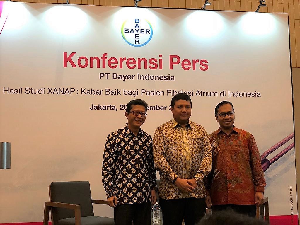 Pasien Fibrilasi Atrium Berisiko Terkena Stroke