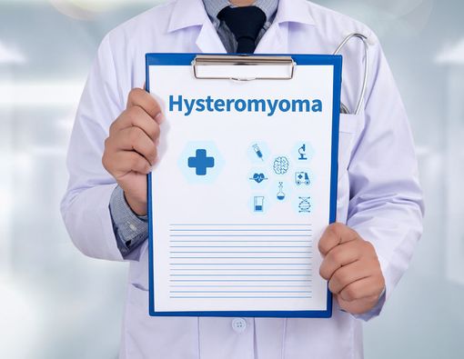 Fakta tentang Miom yang Perlu Anda Tahu