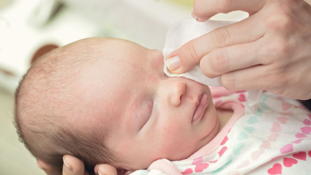 Ilustrasi Mata Bayi Belekan