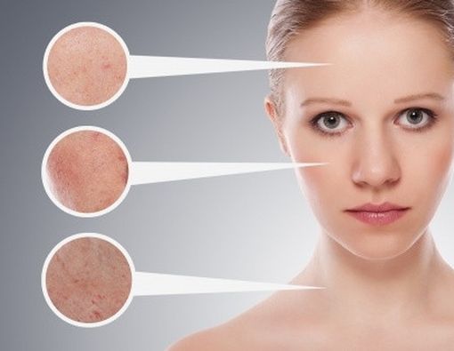 5 Tanda Kulit Sudah Harus Lebih Diperhatikan