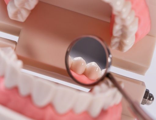 Beberapa Penyebab Gusi Pucat yang Harus Anda Waspadai