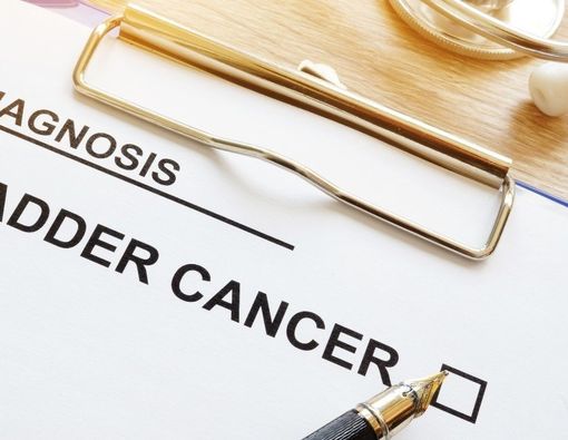 Pilihan Pengobatan untuk Mengatasi Kanker Kandung Kemih