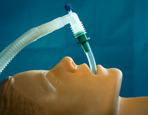 Mengenal Lebih Jauh tentang Intubasi Endotrakeal