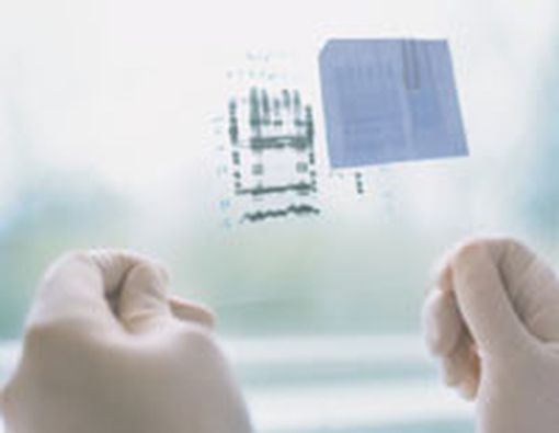 Seberapa Jauh Akurasi Tes DNA?