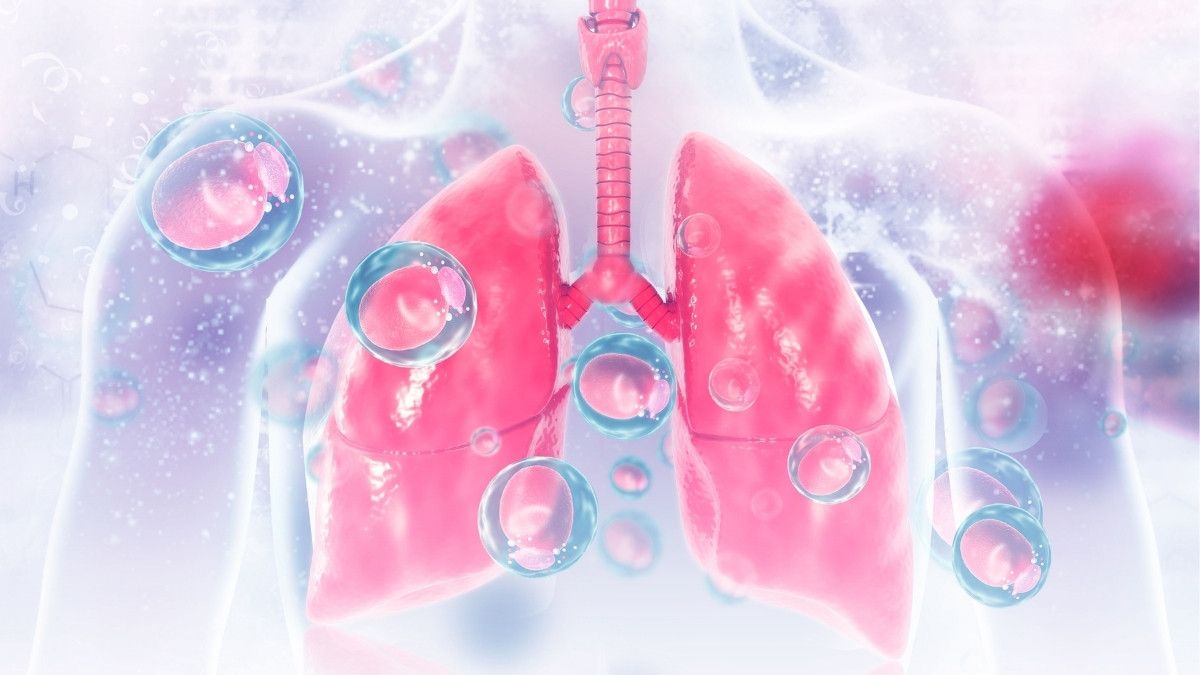 Mengenal Prosedur Lung Lavage, Operasi Pembersihan Paru