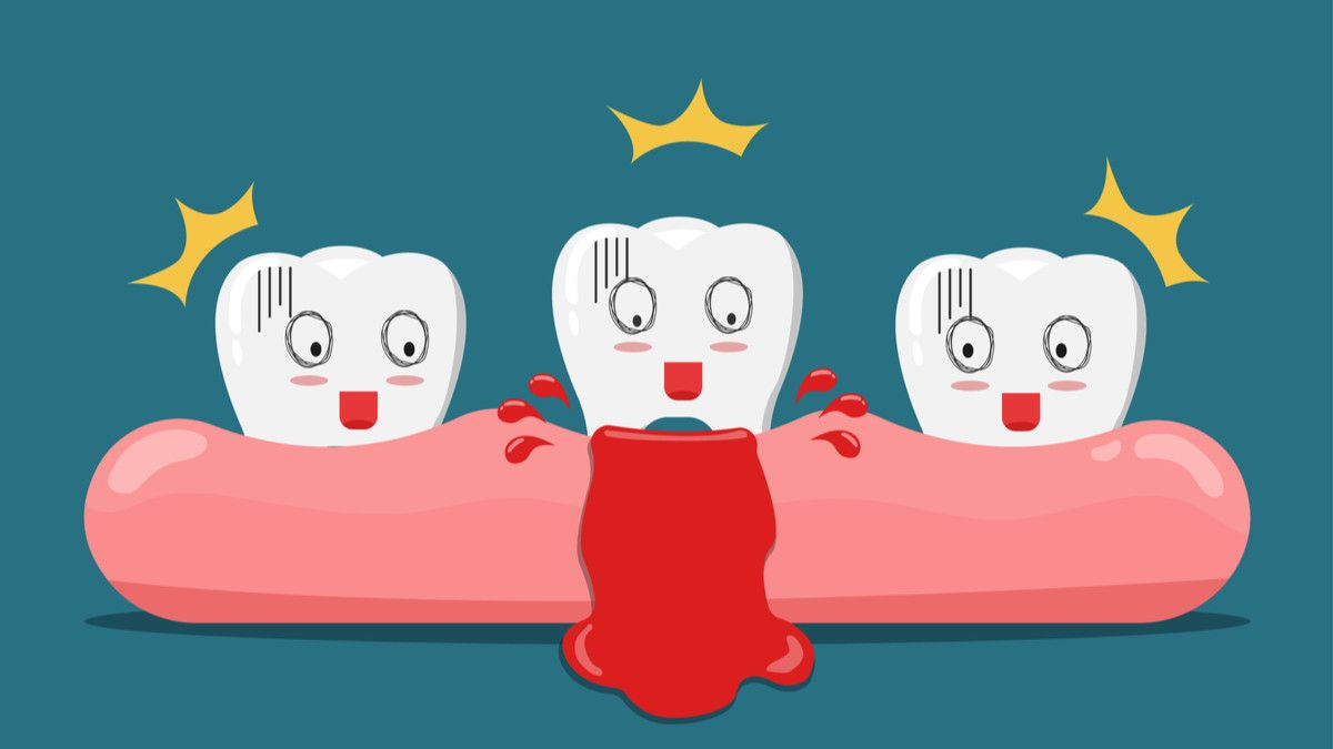 Benarkah Gusi Berdarah Bisa Berujung pada Kanker? (Nawamin/Shutterstock)