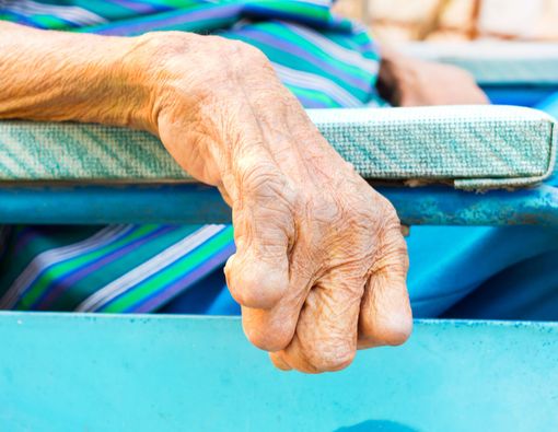 Jangan Sepelekan, Ini Bahaya Kusta Bila Tak Ditangani dengan Tepat