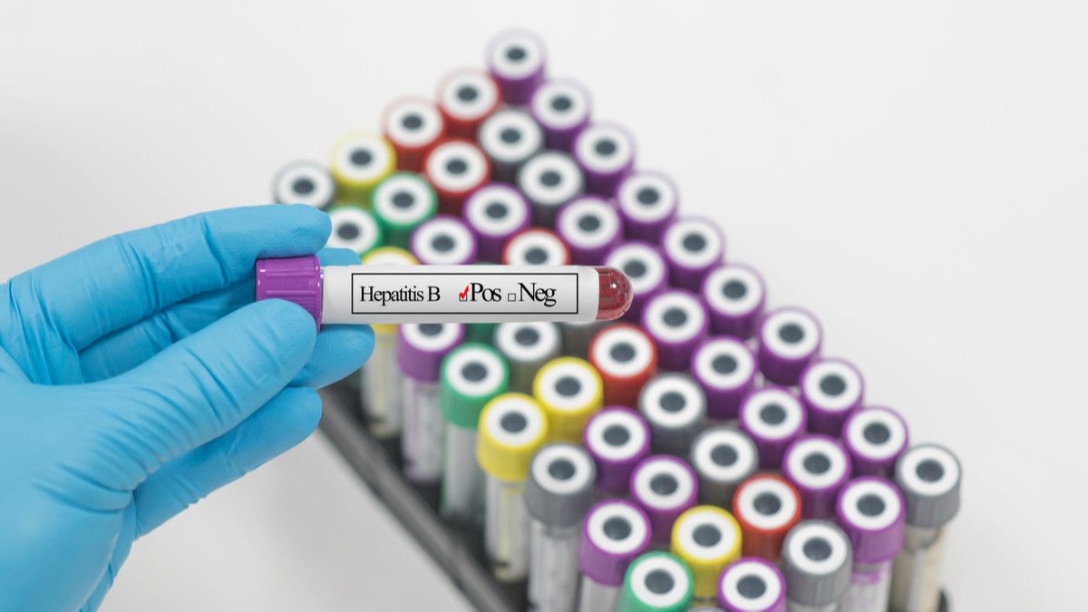 Bagaimana Cara Pemeriksaan Penyakit Hepatitis B?