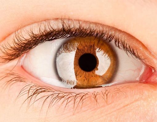 Mata Kedutan, Apa Sebabnya?