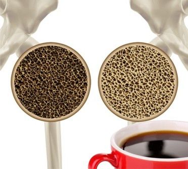 Kebanyakan Kopi Bisa Bikin Tulang Keropos!