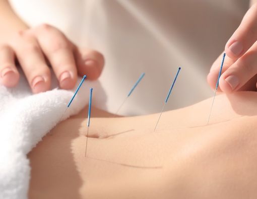 Manfaat Akupuntur untuk Penderita Diabetes