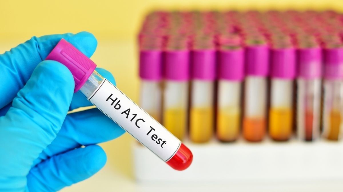 Mengenal Pemeriksaan HBA1C untuk Mengontrol Diabetes