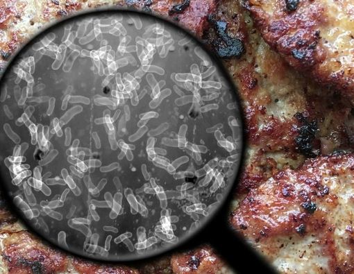 Bahaya Necrotizing Fasciitis, Bisa Sebabkan Tubuh Diamputasi