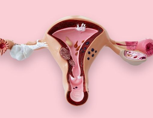 Bisakah Perempuan dengan Kista Ovarium Hamil?